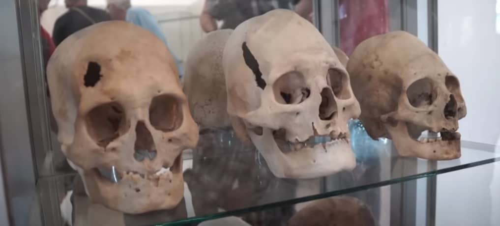 Les crânes allongés : des mystères du passé qui défient notre compréhension